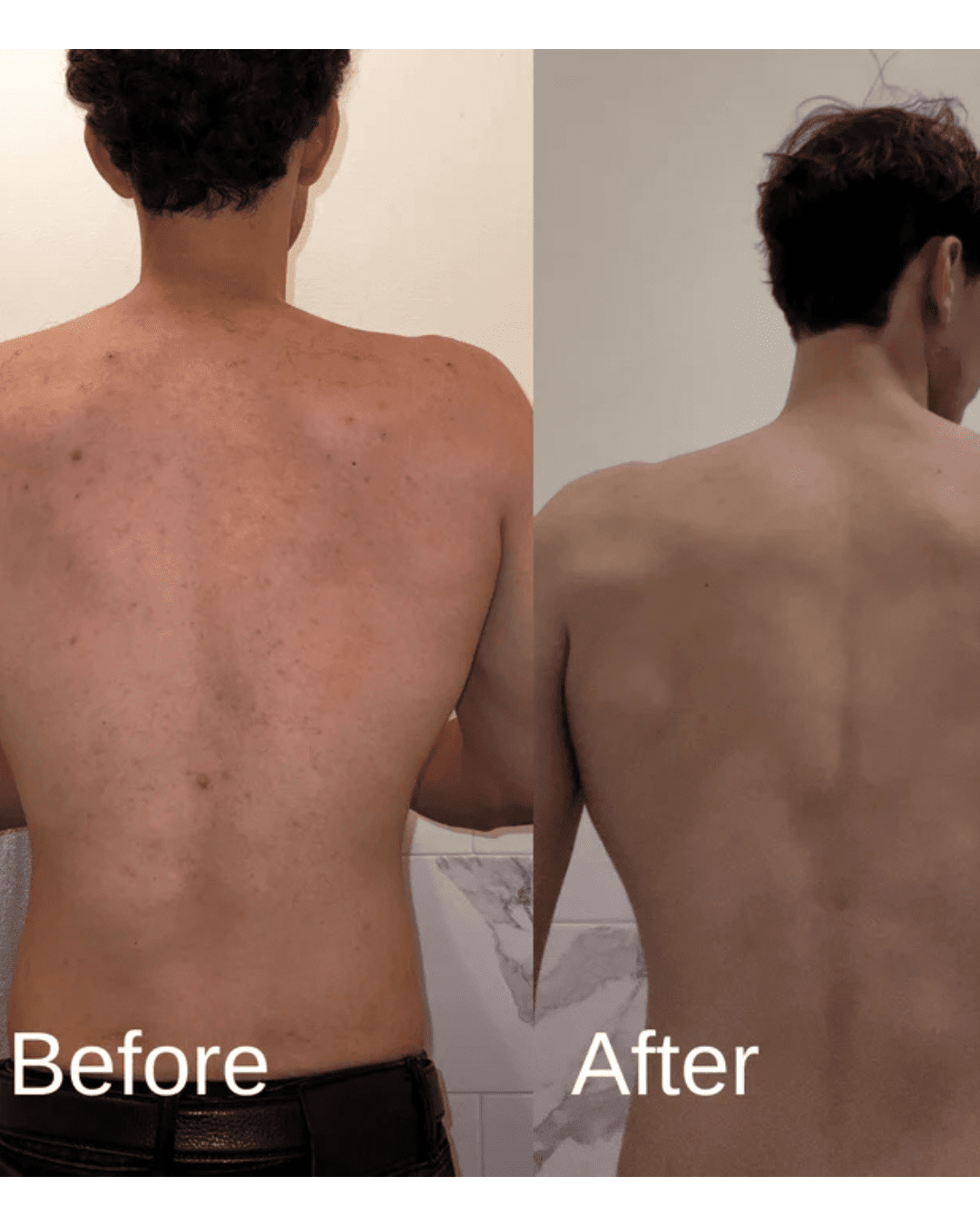 Body Wash + Spray Anti - Acne Corpo - Baron Bear TRIBE